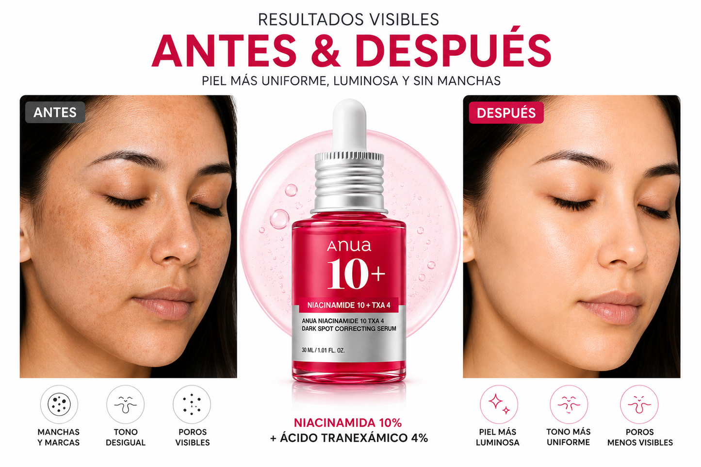 Anua Sérum Antimanchas Niacinamida 10% + Ácido Tranexámico 4% — 30 ml