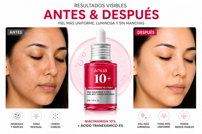 Anua Sérum Antimanchas Niacinamida 10% + Ácido Tranexámico 4% — 30 ml