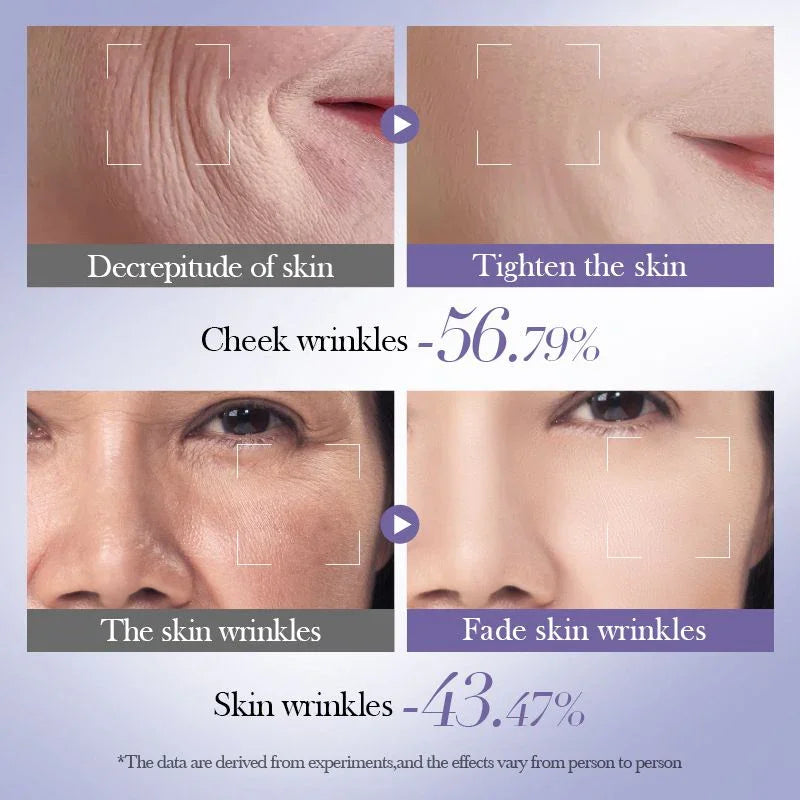 Set Facial Antiarrugas con Retinol y Ácido Hialurónico – Rutina Completa 6 Piezas