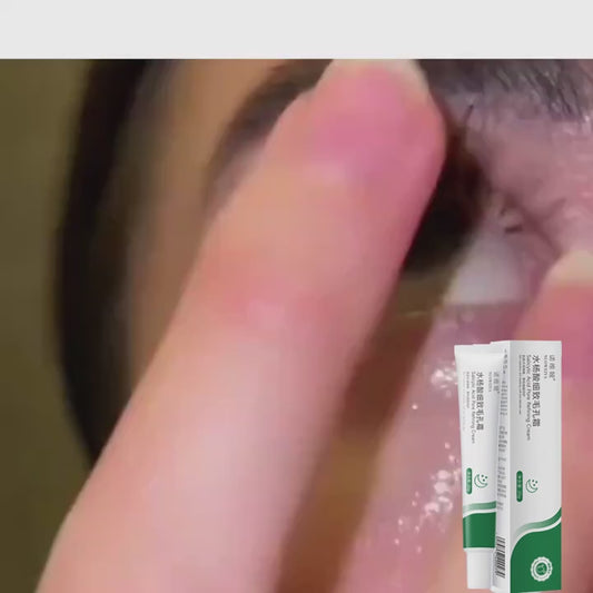 Crema Antiacné Nuoweiya – Con Ácido Salicílico para Poros Limpios